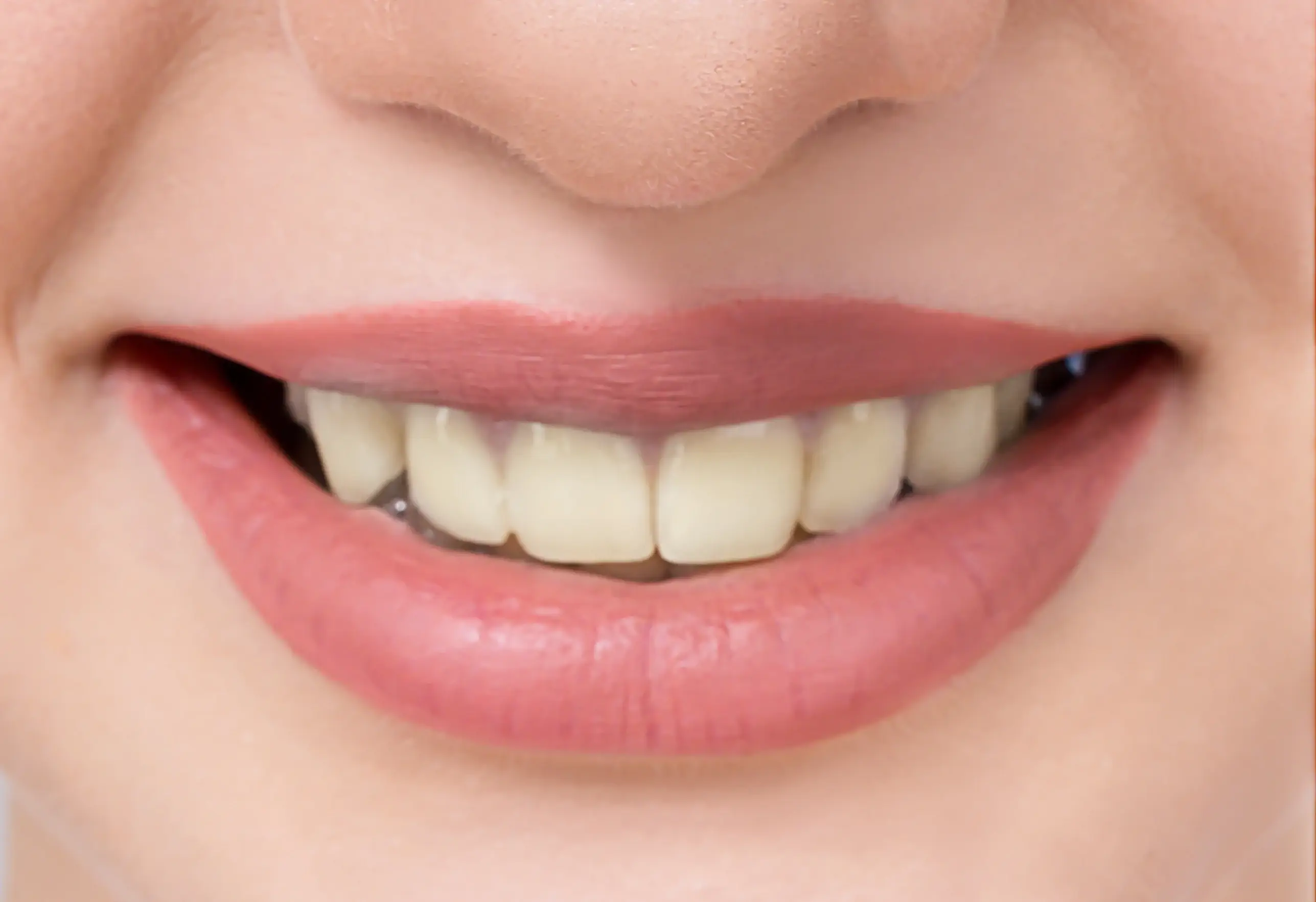 before cosmetic dentistry showing stained teeth